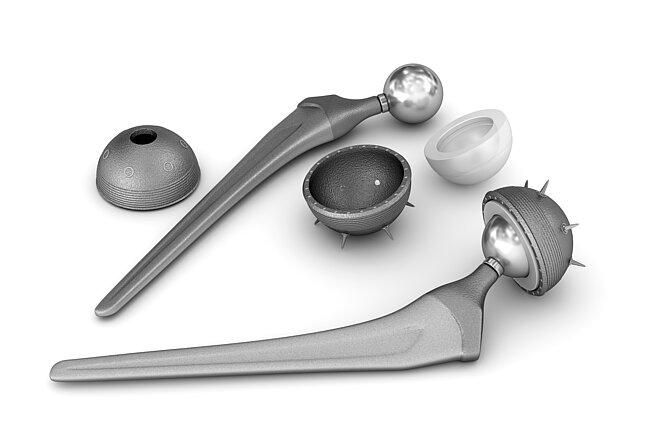Kloubní implantáty - Umělé klouby, které nahrazují poškozený kloub.
