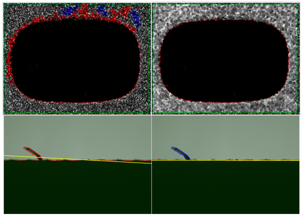 Processamento de imagem - Avaliação de imagem perfeita para óptica e tomografia computorizada